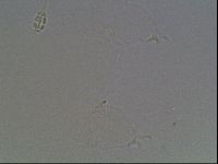 Pilatobius oculatus image